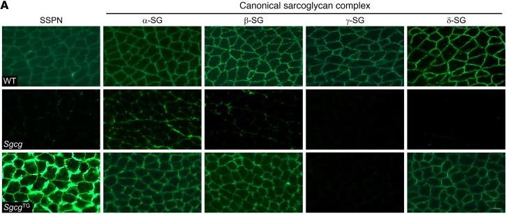 Fig.8.A showing Immunocytochemistry-immunofluorescence in a Mus musculus (House mouse) sample from the publication: Sarcospan protects against LGMD R5 via remodeling of the sarcoglycan complex composition in dystrophic mice.