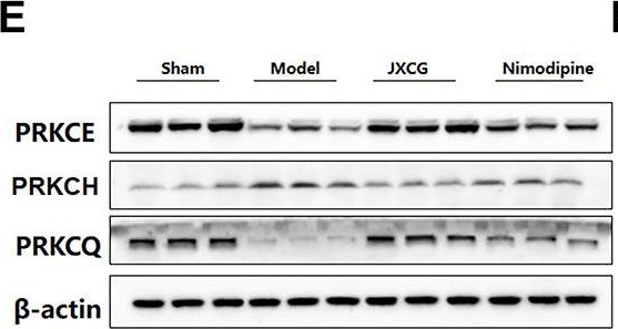 Fig.6.E showing Western Blotting in a Rattus norvegicus (Rat) sample from the publication: Combining metabolomics and network pharmacology to investigate the protective effect of Jiawei Xinglou Chengqi Granules in ischemic stroke.