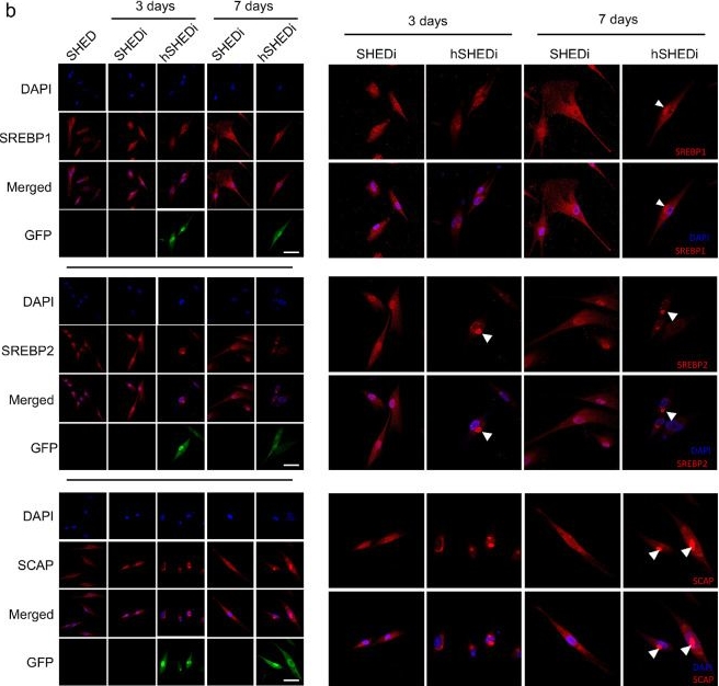 Fig.6.B showing Immunocytochemistry-immunofluorescence from the publication: Human cytomegalovirus infection impairs neural differentiation via repressing sterol regulatory element binding protein 2-mediated cholesterol biosynthesis.