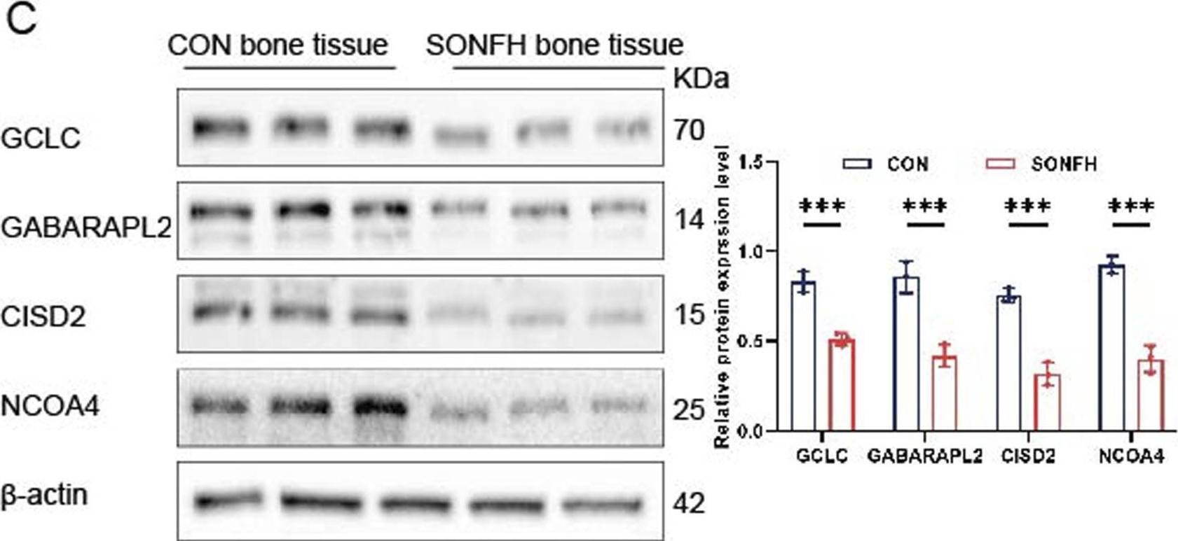 Fig.8.C showing Western Blotting from the publication: Bioinformatics and experimental validation of ferroptosis-related genes in steroid-induced osteonecrosis of the femoral head.