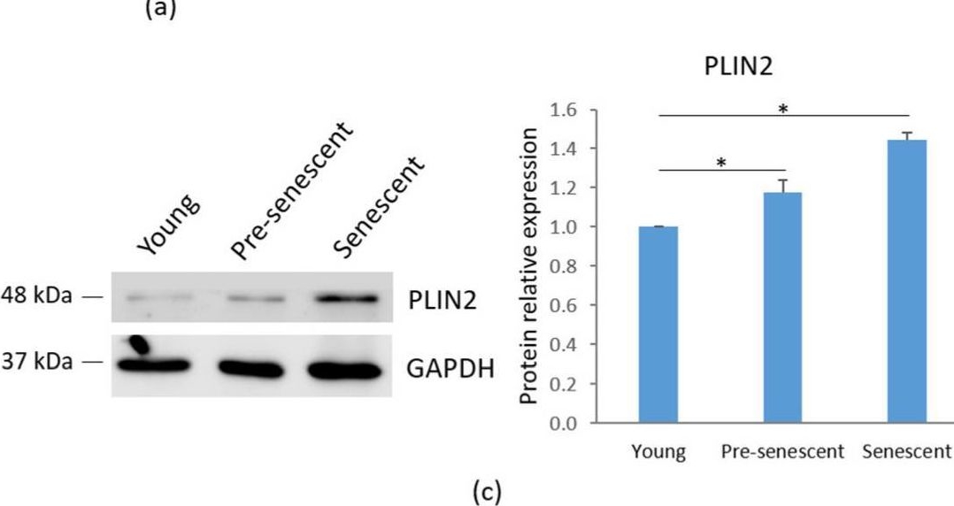 Fig.5.A showing Western Blotting in a Homo sapiens (Human) sample from the publication: Replicative Senescence in Mesenchymal Stem Cells: An In Vitro Study on Mitochondrial Dynamics and Metabolic Alterations.