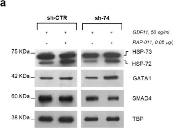Fig.3.A showing Western Blotting in a Homo sapiens (Human) sample from the publication: RAP-011 Rescues the Disease Phenotype in a Cellular Model of Congenital Dyserythropoietic Anemia Type II by Inhibiting the SMAD2-3 Pathway.