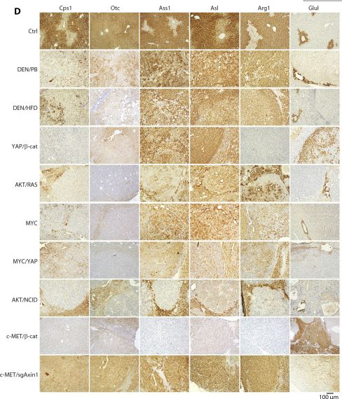 Fig.1.D showing Immunohistochemistry in a Mus musculus (House mouse) sample from the publication: Impaired nitrogenous waste clearance promotes hepatocellular carcinoma.