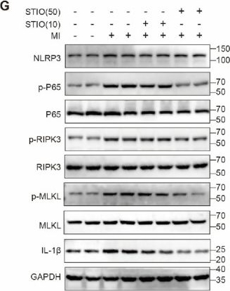 Fig.7.G showing Western Blotting from the publication: β-sitosterol ameliorates myocardial infarction injury via modulating the NF-κB and necroptosis signaling pathways.