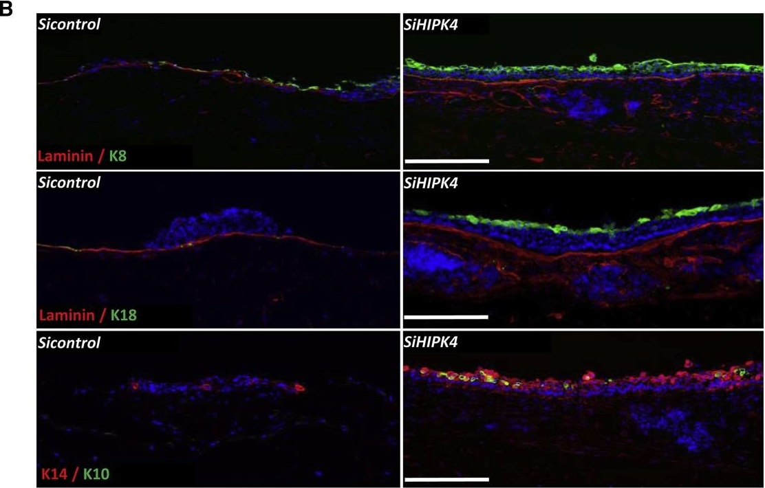 An RNAi Screen Reveals an Essential Role for HIPK4 in Human Skin Epithelial Differentiation from iPSCs.