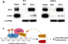 Fig.6.B showing Western Blotting from the publication: Phosphorylation of islet-1 serine 269 by CDK1 increases its transcriptional activity and promotes cell proliferation in gastric cancer.
