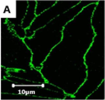 Fig.4.A showing Immunocytochemistry-immunofluorescence in a Bos taurus (Bovine) sample from the publication: Effects of oxygen-glucose deprivation (OGD) on barrier properties and mRNA transcript levels of selected marker proteins in brain endothelial cells/astrocyte co-cultures.