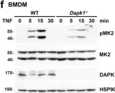 Fig.5.F showing Western Blotting from the publication: Tumor suppressor death-associated protein kinase 1 inhibits necroptosis by p38 MAPK activation.