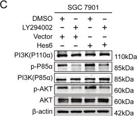 Fig.6.C showing Western Blotting from the publication: Transcription cofactor Hes6 interacts with Twist1 to facilitate EMT and promote gastric carcinogenesis by activating the PI3K/AKT signaling.