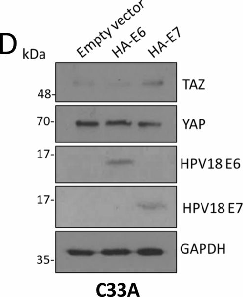 Fig.2.D showing Western Blotting in a Homo sapiens (Human) sample from the publication: The Hippo pathway transcription factors YAP and TAZ play HPV-type dependent roles in cervical cancer.