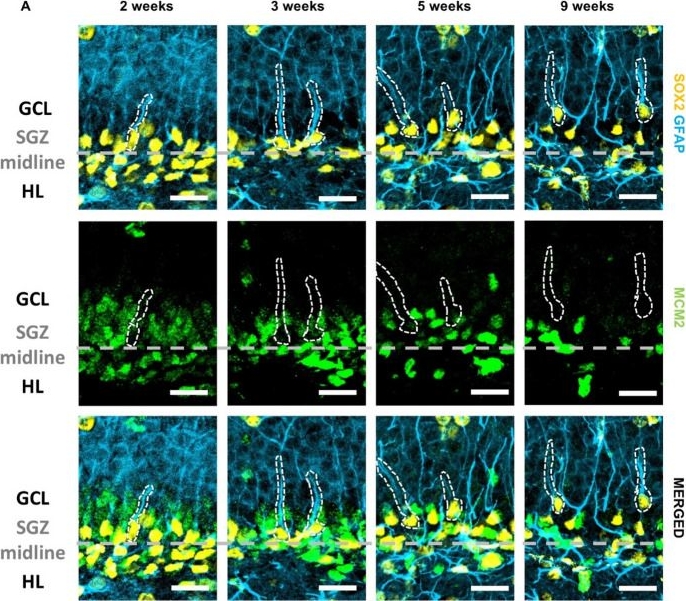 Fig.3.A showing Immunohistochemistry-immunofluorescence from the publication: Postnatal development of the dentate gyrus vascular niche.