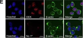 Fig.2.E showing Immunocytochemistry-immunofluorescence from the publication: DEK regulates B-cell proliferative capacity and is associated with aggressive disease in low-grade B-cell lymphomas.