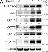 Fig.2.A showing Western Blotting from the publication: Glutaminolysis provides nucleotides and amino acids to regulate osteoclast differentiation in mice.