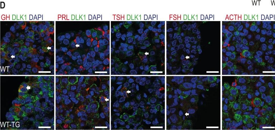 Fig.1.D showing Immunohistochemistry-immunofluorescence in a Mus musculus (House mouse) sample from the publication: Imprinted Dlk1 dosage as a size determinant of the mammalian pituitary gland.
