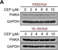 Fig.5.A showing Western Blotting from the publication: Targeting PI4KA sensitizes refractory leukemia to chemotherapy by modulating the ERK/AMPK/OXPHOS axis.
