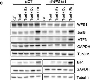Fig.4.C showing Western Blotting in a Homo sapiens (Human) sample from the publication: GLP-1R agonists demonstrate potential to treat Wolfram syndrome in human preclinical models.