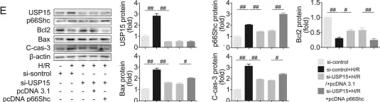 Fig.7.E showing Western Blotting from the publication: USP15 regulates p66Shc stability associated with Drp1 activation in liver ischemia/reperfusion.