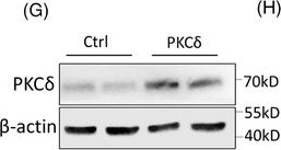 Fig.3.G showing Western Blotting from the publication: PKCδ serves as a potential biomarker and therapeutic target for microglia-mediated neuroinflammation in Alzheimer's disease.