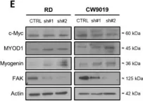Fig.2.E showing Western Blotting from the publication: Dickkopf-1 Inhibition Reactivates Wnt/β-Catenin Signaling in Rhabdomyosarcoma, Induces Myogenic Markers In Vitro and Impairs Tumor Cell Survival In Vivo.