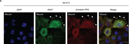 Fig.3.D showing Immunocytochemistry-immunofluorescence from the publication: BART inhibits pancreatic cancer cell invasion by PKCα inactivation through binding to ANX7.