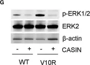 Fig.4.G showing Western Blotting from the publication: Rational Targeting of Cdc42 Overcomes Drug Resistance of Multiple Myeloma.