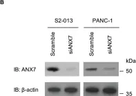 Fig.2.B showing Western Blotting in a Homo sapiens (Human) sample from the publication: BART inhibits pancreatic cancer cell invasion by PKCα inactivation through binding to ANX7.