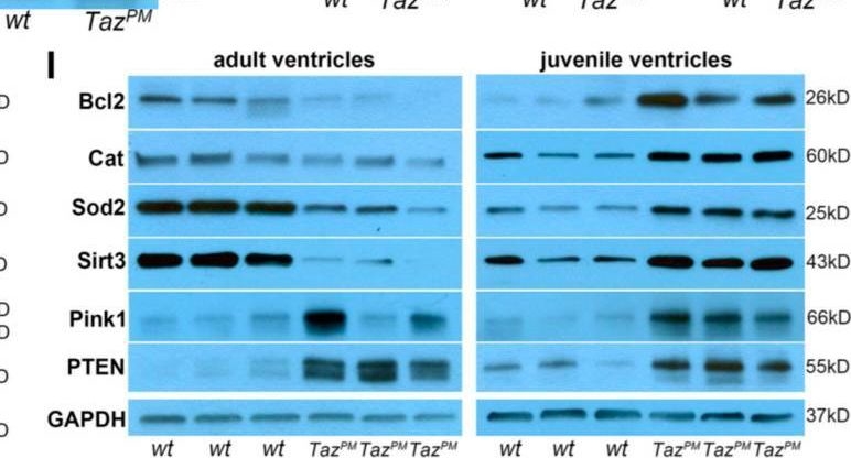 Fig.4.I showing Western Blotting in a Mus musculus (House mouse) sample from the publication: A Barth Syndrome Patient-Derived D75H Point Mutation in TAFAZZIN Drives Progressive Cardiomyopathy in Mice.