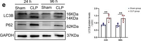 Fig.2.E showing Western Blotting in a Mus musculus (House mouse) sample from the publication: PACS2 Alleviates Sepsis-Induced Myopathy by Activating ERK-MAPK Signalling Pathway to Suppress ER-Phagy.