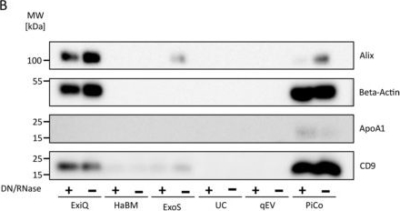 Fig.4.B showing Western Blotting from the publication: Comparison of Methods for the Isolation of Salivary Extracellular Vesicles.