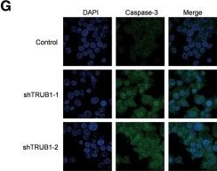 Fig.4.G showing Immunocytochemistry-immunofluorescence in a Homo sapiens (Human) sample from the publication: TRUB1 is a novel biomarker for promoting malignancy in colorectal cancer via NFκB signaling.