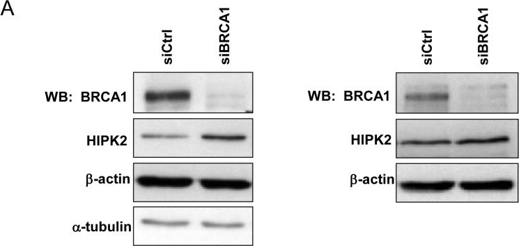 Fig.4.A showing Western Blotting in a Homo sapiens (Human) sample from the publication: BRCA1-Dependent Translational Regulation in Breast Cancer Cells.