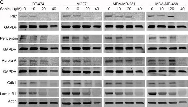 Fig.7.C showing Western Blotting in a Homo sapiens (Human) sample from the publication: Separase Inhibitor Sepin-1 Inhibits Foxm1 Expression and Breast Cancer Cell Growth.