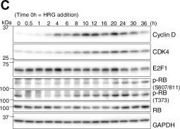 Fig.2.C showing Western Blotting from the publication: The receptor tyrosine kinase ErbB2/HER2 governs CDK4 inhibitor sensitivity, timing, and irreversibility of the G1/S transition.