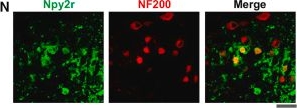 Fig.2.N showing Immunohistochemistry-immunofluorescence from the publication: Development of a 3-dimensional organotypic model with characteristics of peripheral sensory nerves.