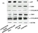 Fig.3.A showing Western Blotting from the publication: DRF 3188 a novel semi-synthetic analog of andrographolide: cellular response to MCF 7 breast cancer cells.
