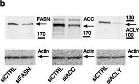 Fig.3.B showing Western Blotting in a Homo sapiens (Human) sample from the publication: A human genome-wide loss-of-function screen identifies effective chikungunya antiviral drugs.