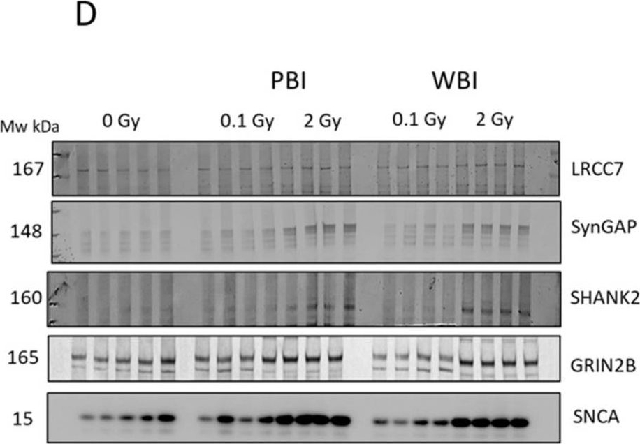 Fig.6.D showing Western Blotting in a Mus musculus (House mouse) sample from the publication: Out-of-Field Hippocampus from Partial-Body Irradiated Mice Displays Changes in Multi-Omics Profile and Defects in Neurogenesis.