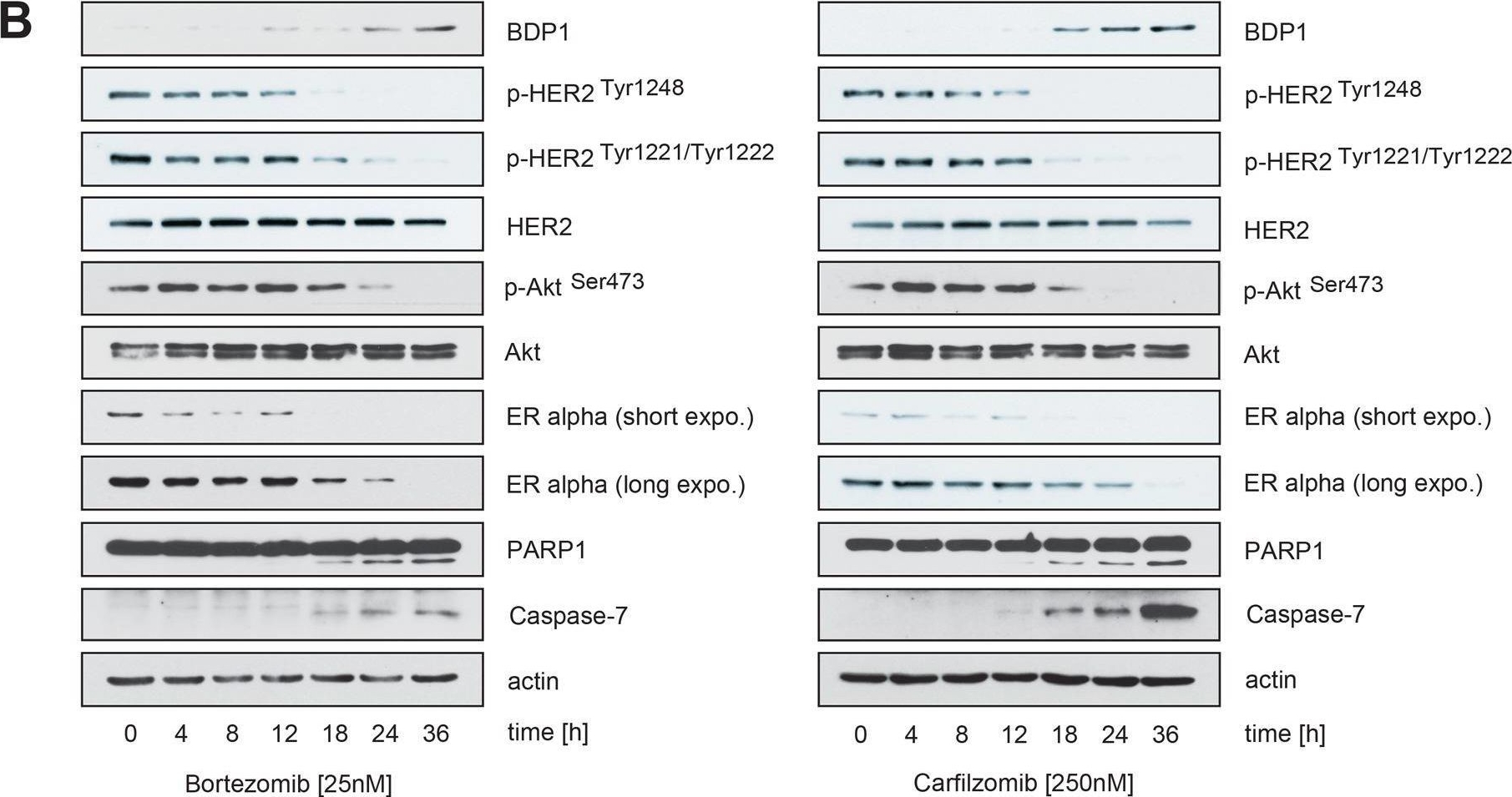 Fig.4.B showing Western Blotting in a Homo sapiens (Human) sample from the publication: Proteasome inhibitors prevent bi-directional HER2/estrogen-receptor cross-talk leading to cell death in endocrine and lapatinib-resistant HER2+/ER+ breast cancer cells.