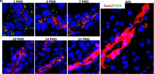 Fig.8.B showing Immunohistochemistry in a Rattus norvegicus (Rat) sample from the publication: Characterization of the pattern of expression of Gas1 in the kidney during postnatal development in the rat.