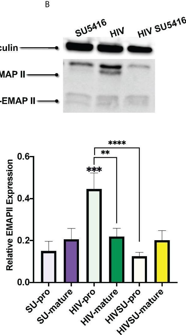 Fig.7.B showing Western Blotting in a Mus musculus (House mouse) sample from the publication: Mice with humanized immune system as novel models to study HIV-associated pulmonary hypertension.