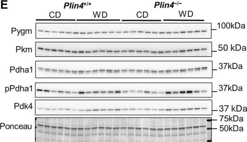 Fig.7.E showing Western Blotting from the publication: Elevated adipose inflammation, but reduced hepatic triacylglycerol storage in diet-induced obese Plin4-/- mice.