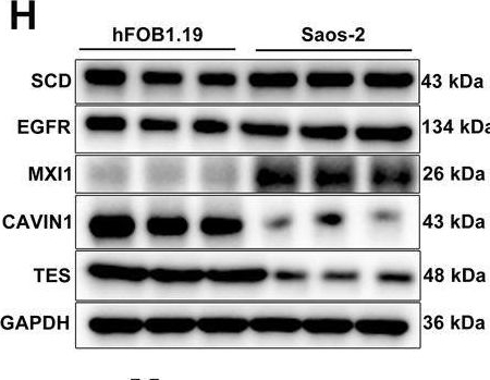 Fig.11.H showing Western Blotting in a Homo sapiens (Human) sample from the publication: Development and Verification of a Hypoxic Gene Signature for Predicting Prognosis, Immune Microenvironment, and Chemosensitivity for Osteosarcoma.