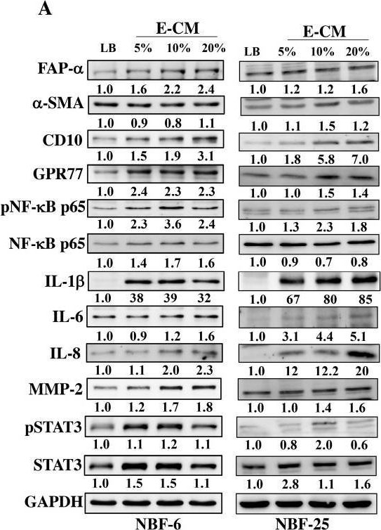 Fig.1.A showing Western Blotting in a Homo sapiens (Human) sample from the publication: Activation of Mammary Epithelial and Stromal Fibroblasts upon Exposure to Escherichia coli Metabolites.