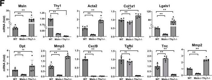 Fig.9.F from the publication: Mesothelin/Mucin 16 Signaling in Activated Portal Fibroblasts Drives the Development of Cholestatic Fibrosis and Hepatocellular Carcinoma in Aged Female Multidrug Resistance Protein 2 Knockout Mice.