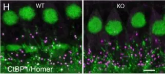 Fig.1.H showing Immunohistochemistry-immunofluorescence in a Mus musculus (House mouse) sample from the publication: The presynaptic ribbon maintains vesicle populations at the hair cell afferent fiber synapse.