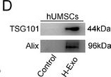 Fig.1.D showing Western Blotting in a Mus musculus (House mouse) sample from the publication: Targeting the ARRDC3-DRP1 Axis via hUMSC-Derived Exosomal CRYAB for Neuroprotection in Cerebral Ischemia/Reperfusion Injury.