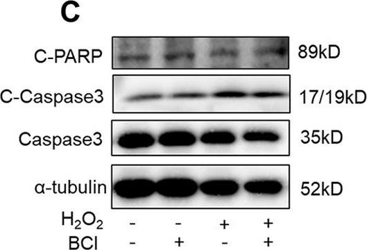 Fig.2.C showing Western Blotting in a Rattus norvegicus (Rat) sample from the publication: A DUSP6 inhibitor suppresses inflammatory cardiac remodeling and improves heart function after myocardial infarction.