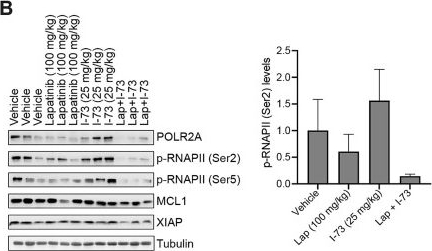 Fig.6.B showing Western Blotting in a Mus musculus (House mouse) sample from the publication: Disrupting CDK9 activity suppresses triple-negative breast cancer and is enhanced by EGFR Inhibition.