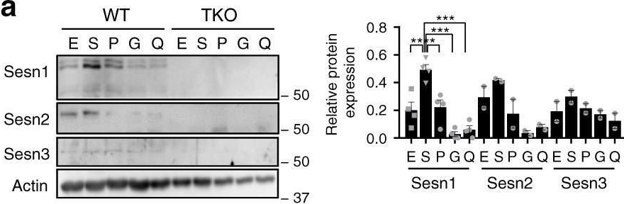 Fig.5.A showing Western Blotting from the publication: Sestrins are evolutionarily conserved mediators of exercise benefits.