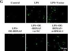 Fig.5.G showing Immunocytochemistry-immunofluorescence in a Mus musculus (House mouse) sample from the publication: BMAL1 alleviates sepsis-induced acute kidney injury by inhibiting apoptosis, ferroptosis and inflammation.